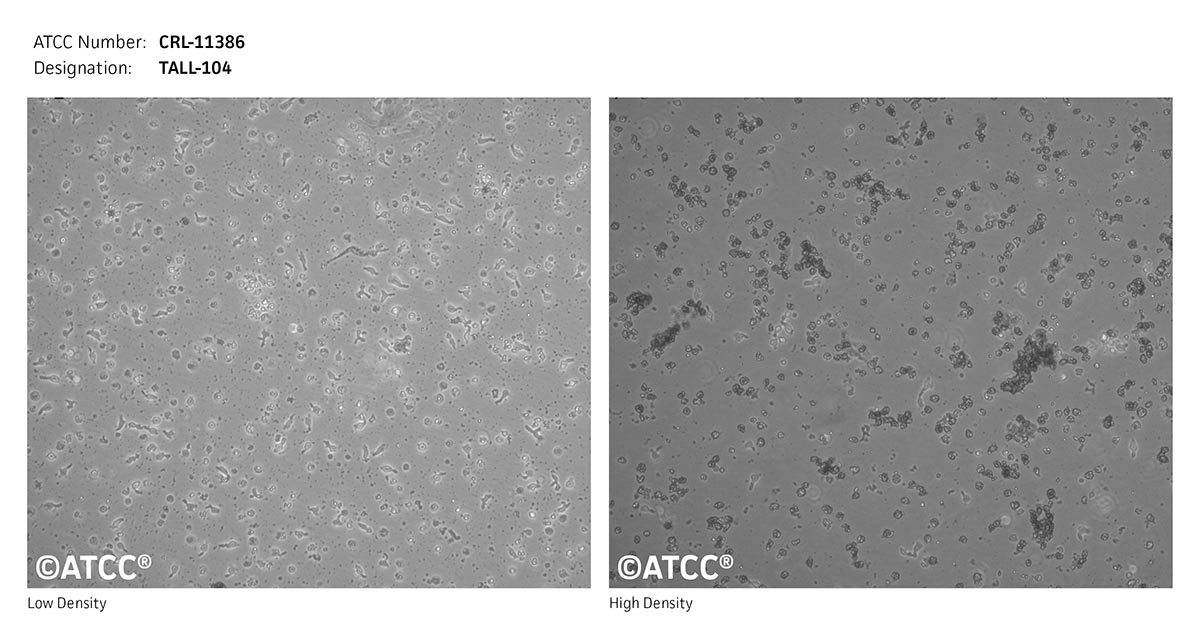 Cell Micrograph of ATCC CRL-11186, TALL-104