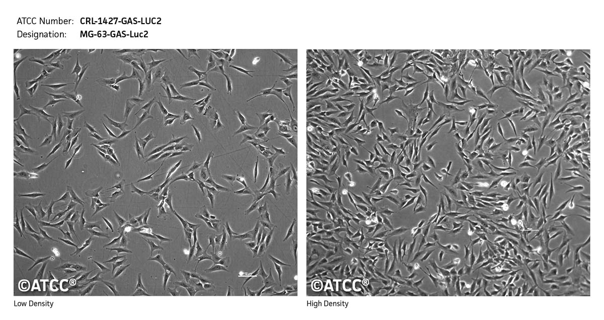 Cell Micrograph  CRL-1427-GAS-LUC2