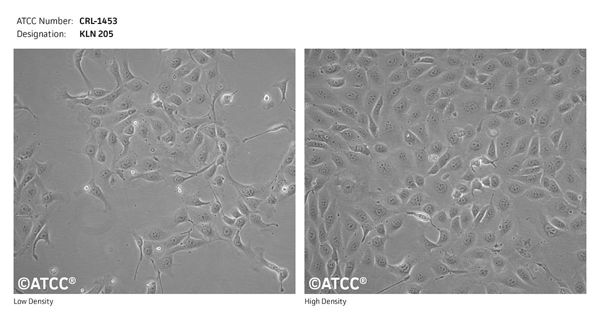 Cell Micrograph KLN 205, ATCC CRL-1453 cells 