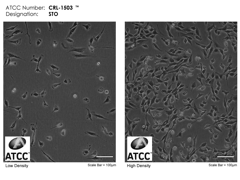 ATCC CRL-1503 Cell Micrograph