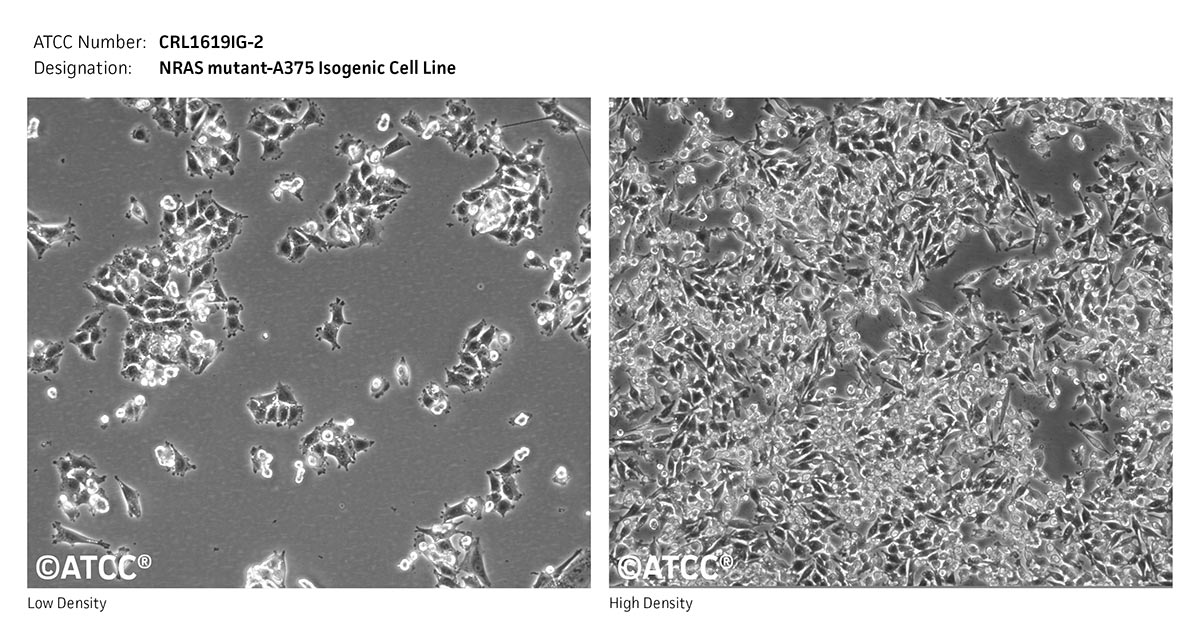 Cell Micrograph of NRAS mutant-A375 Isogenic Cell Line, ATCC CRL-1619IG-2