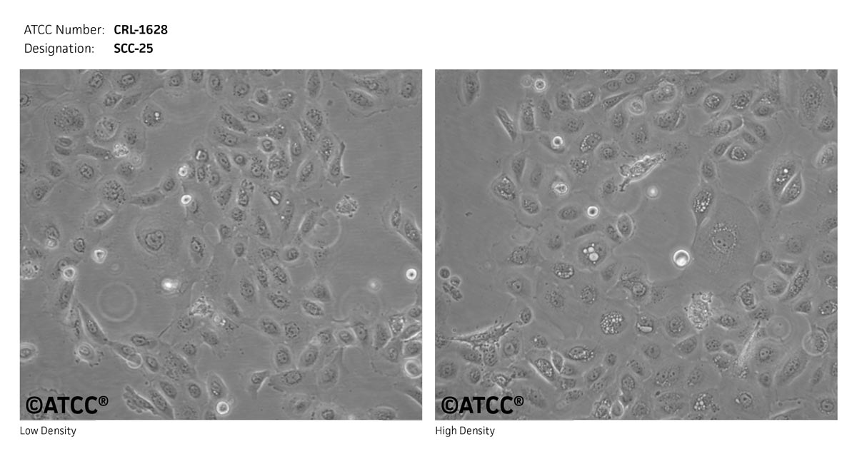 ATCC CRL-1628 Cell Micrograph