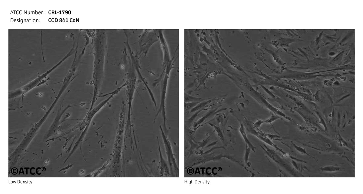 CCD 841 CoN - CRL-1790 | ATCC