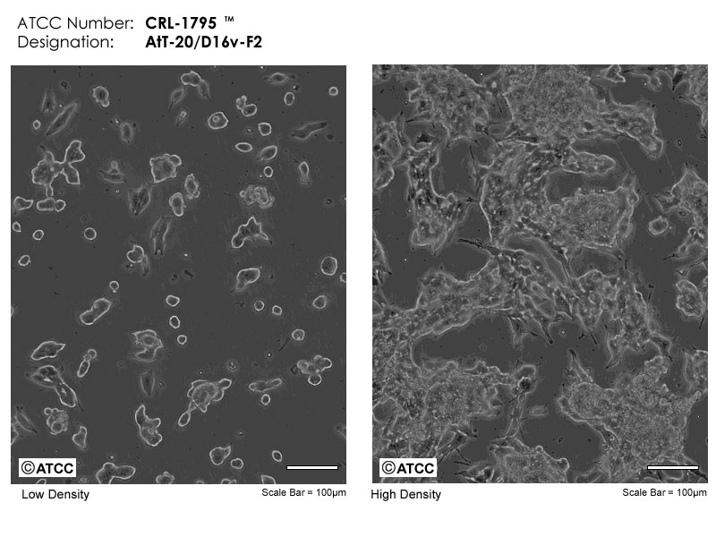 Cell Micrograph of AtT-20/D16v-F2, ATCC CRL-1795 cells