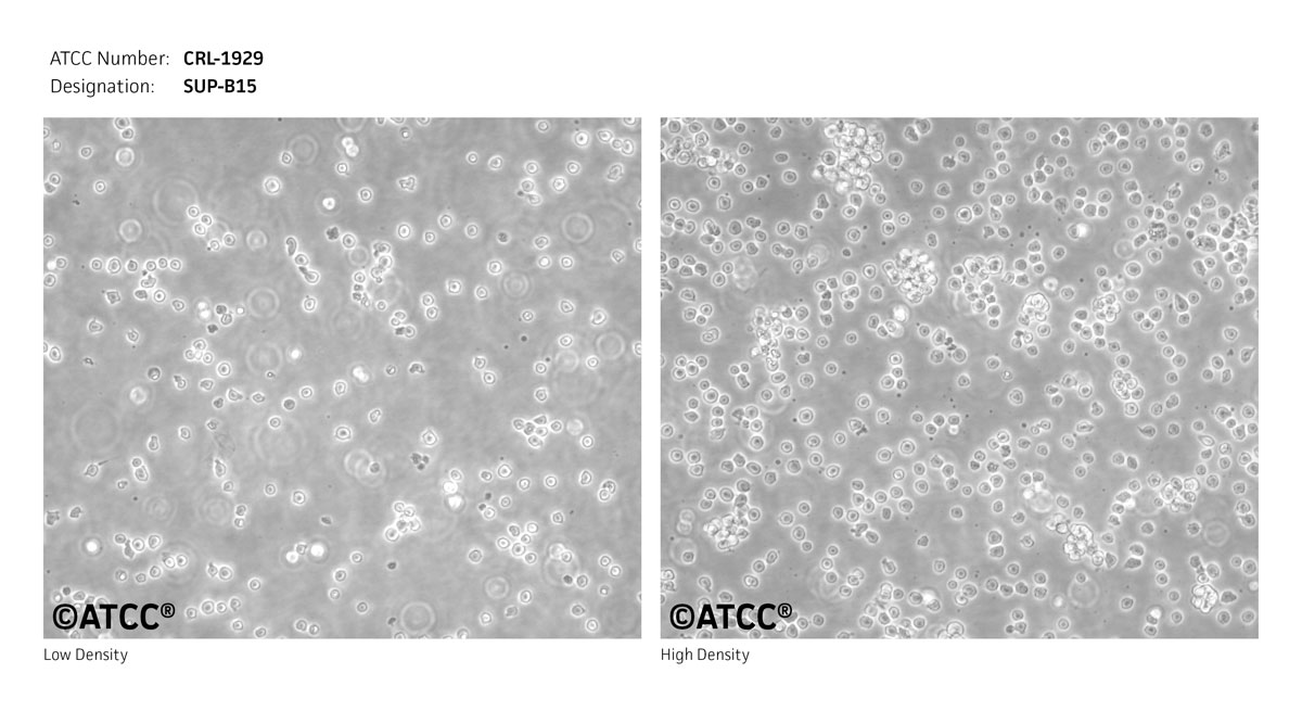 Cell Micrograph of ATCC CRL-1929