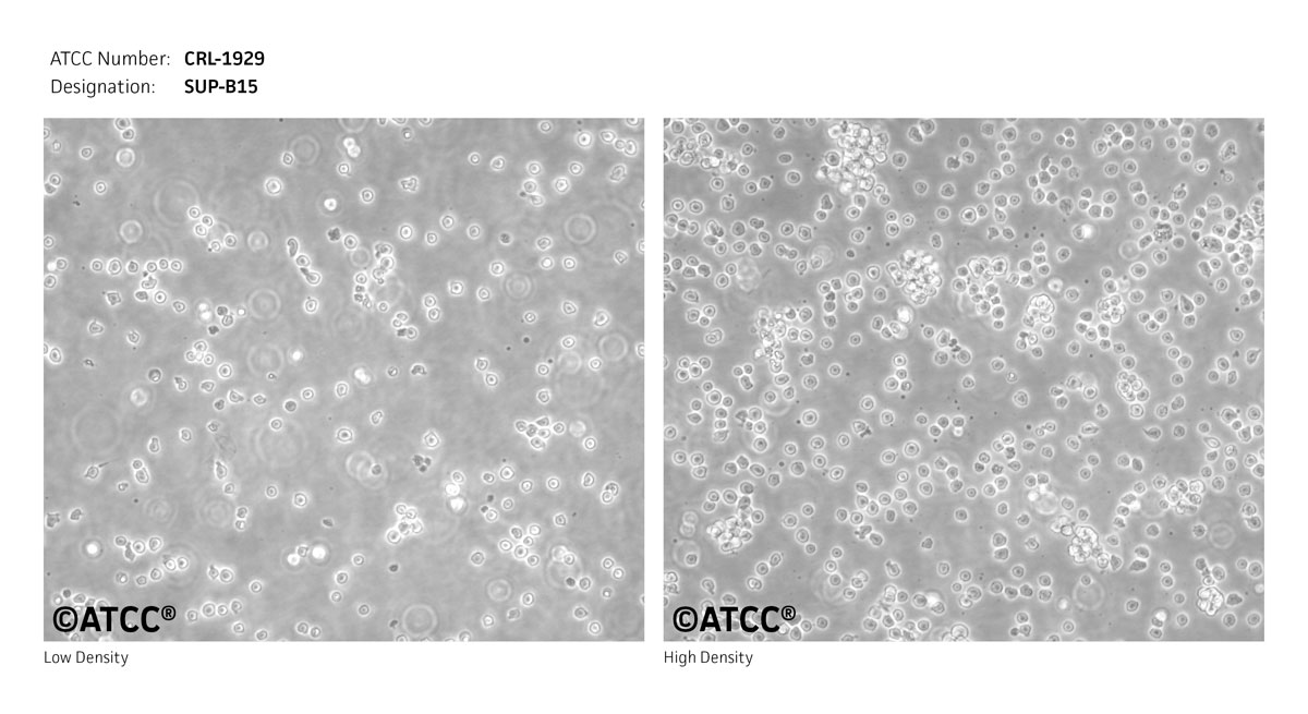 Cell Micrograph of ATCC CRL-1929