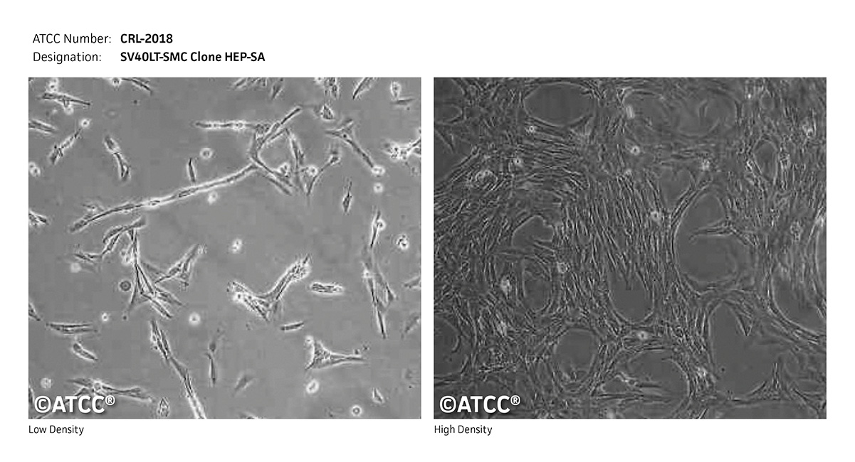 CRL-2018 Micrograph