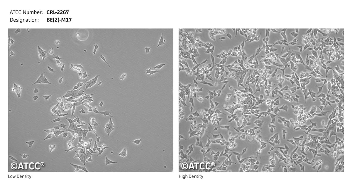 Micrograph of ATCC CRL-2267