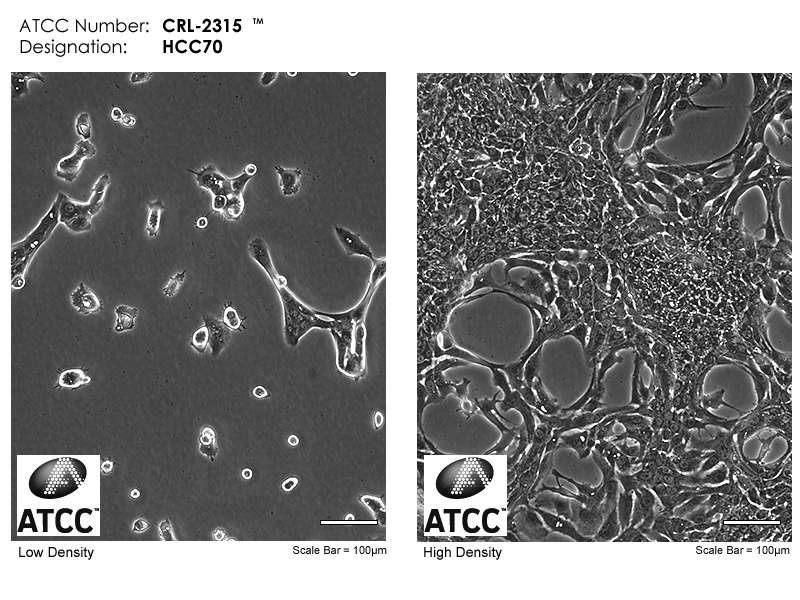 ATCC CRL-2315 Micrograph