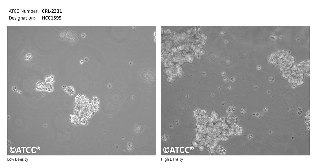 Cell Micrograph ATCC CRL-2331, HCC1599