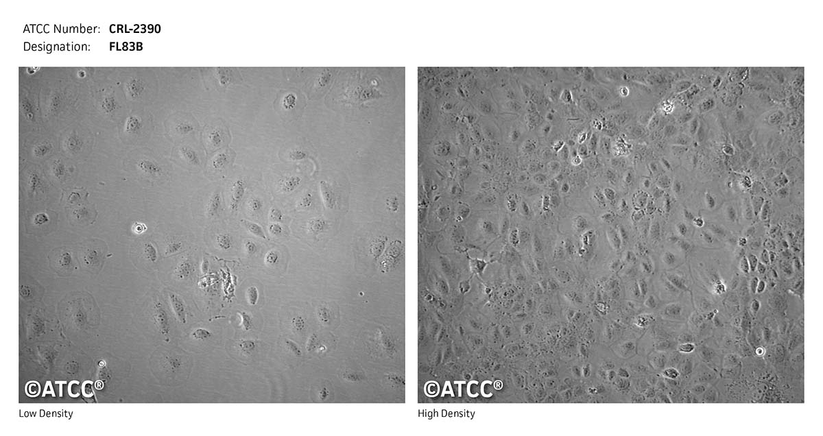 Micrograph of ATCC CRL-2390