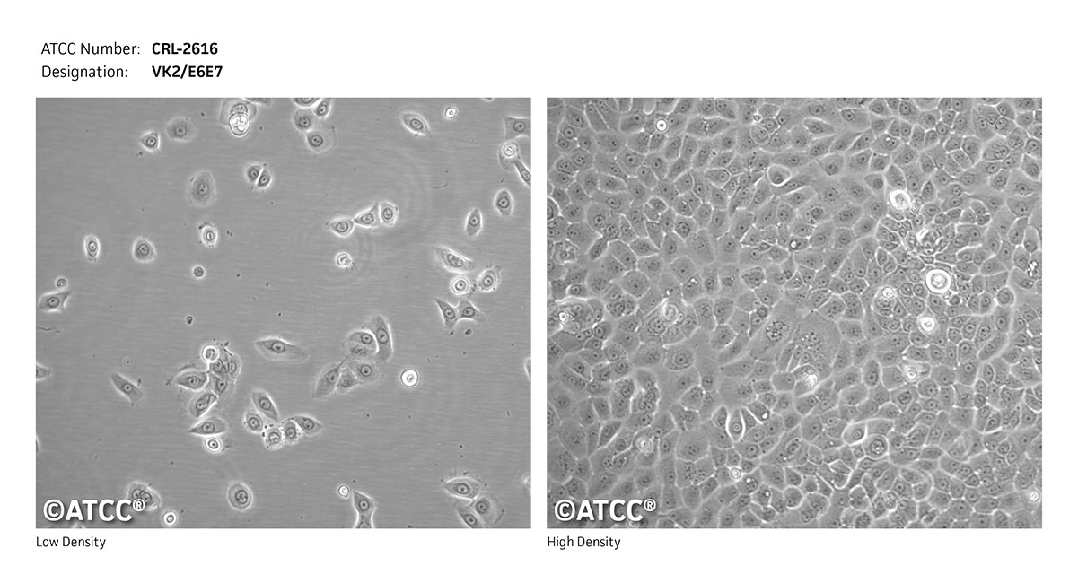 CRL-2616 micrograph