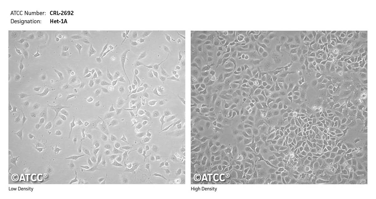 Cell micrograph of ATCC CRL-2692