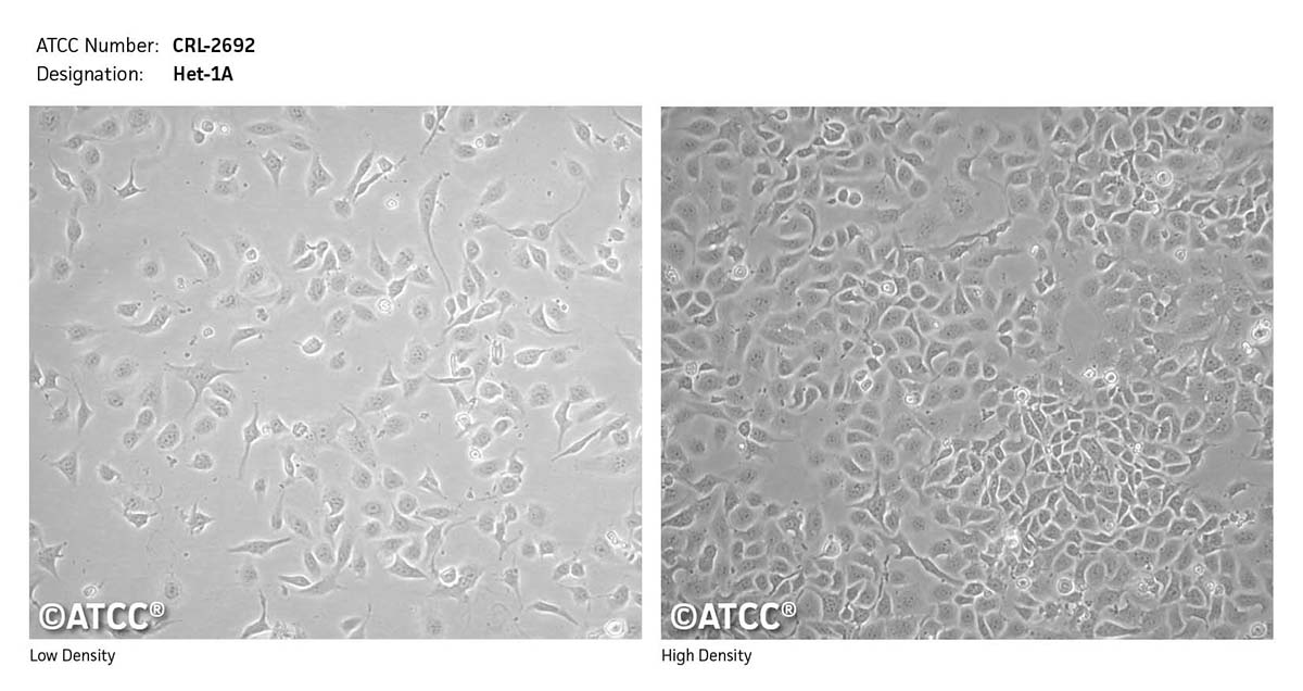 Cell micrograph of ATCC CRL-2692