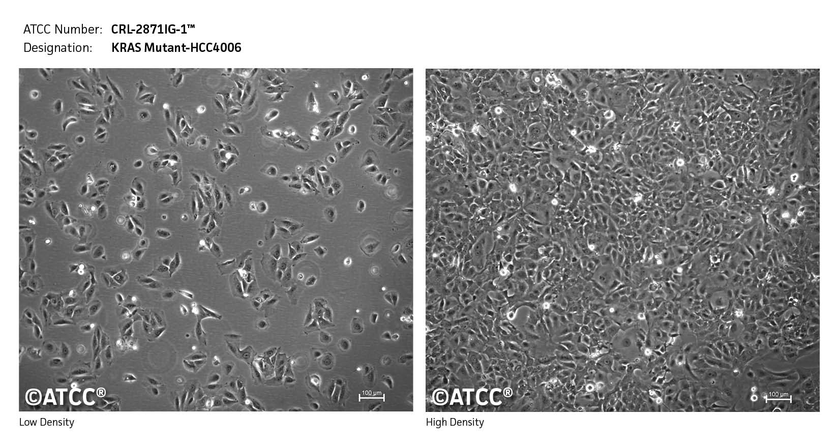 Micrograph of CRL-2871IG-1 Low High