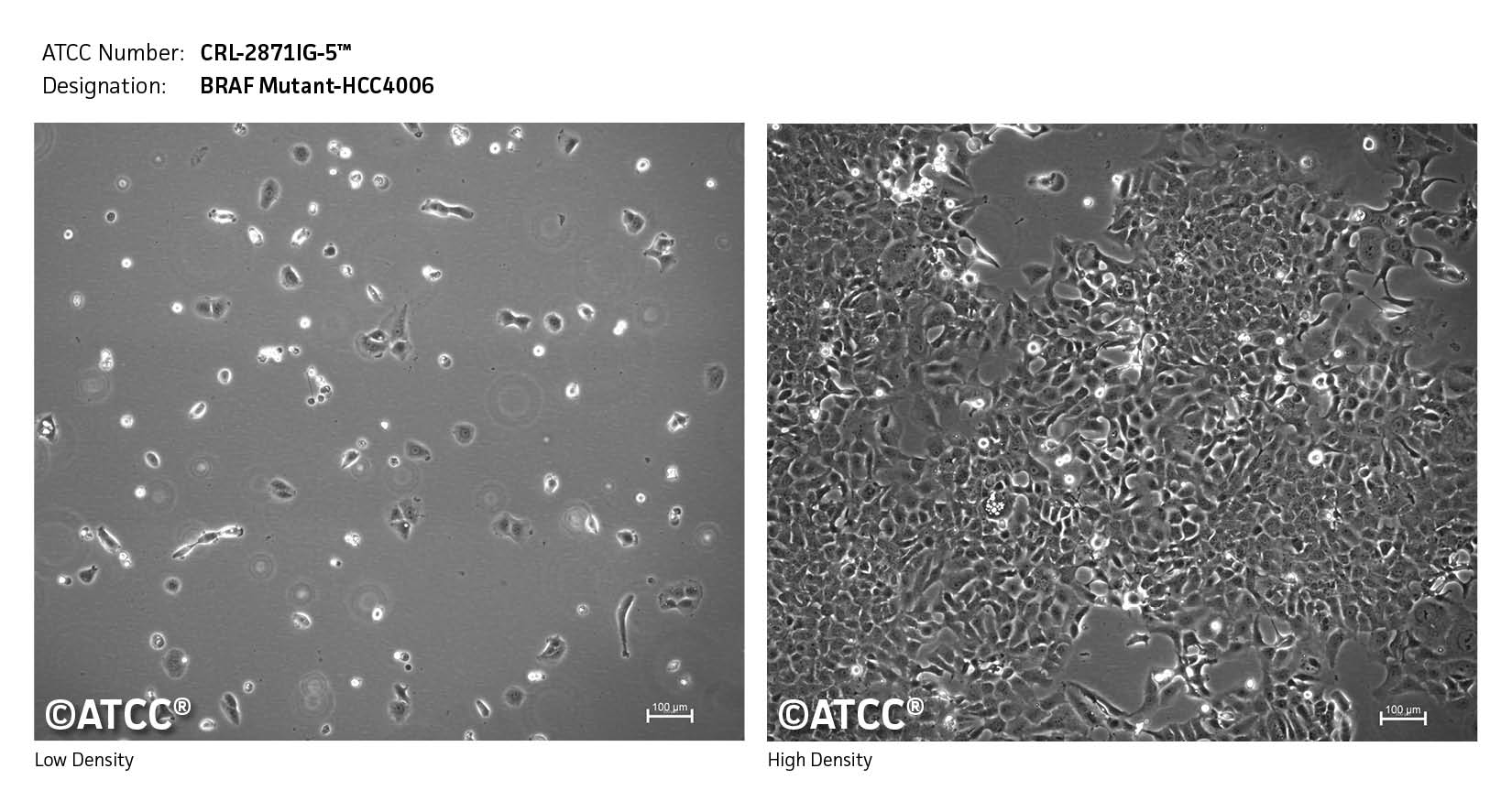 Micrograph of CRL-2871IG-5 Low High
