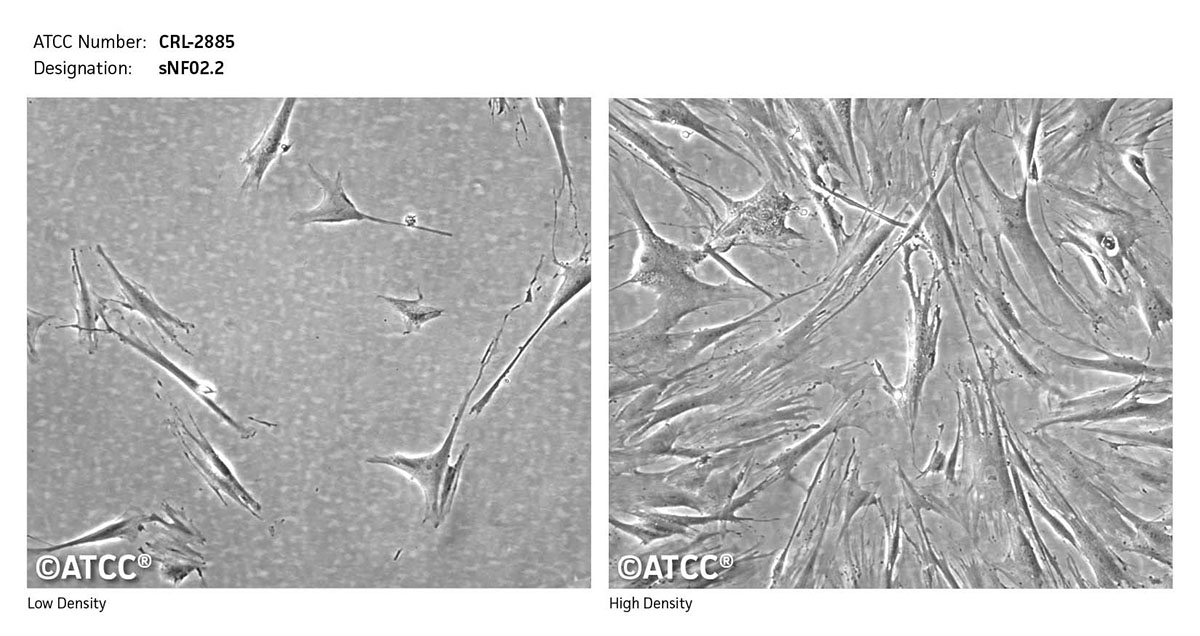 Cell micrograph of CRL-2885