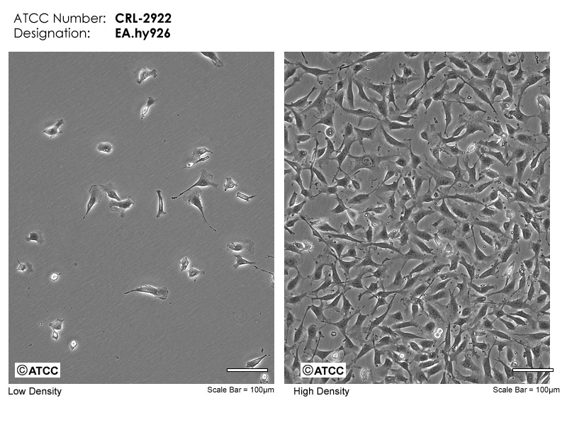 Cell Micrograph EA.hy926, ATCC CRL-2922 cells