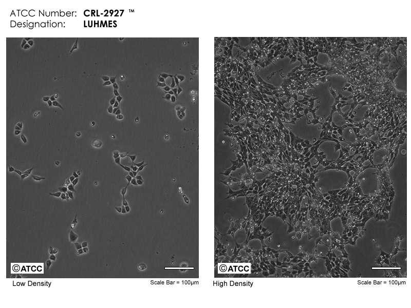 ATCC CRL-2927 Micrograph
