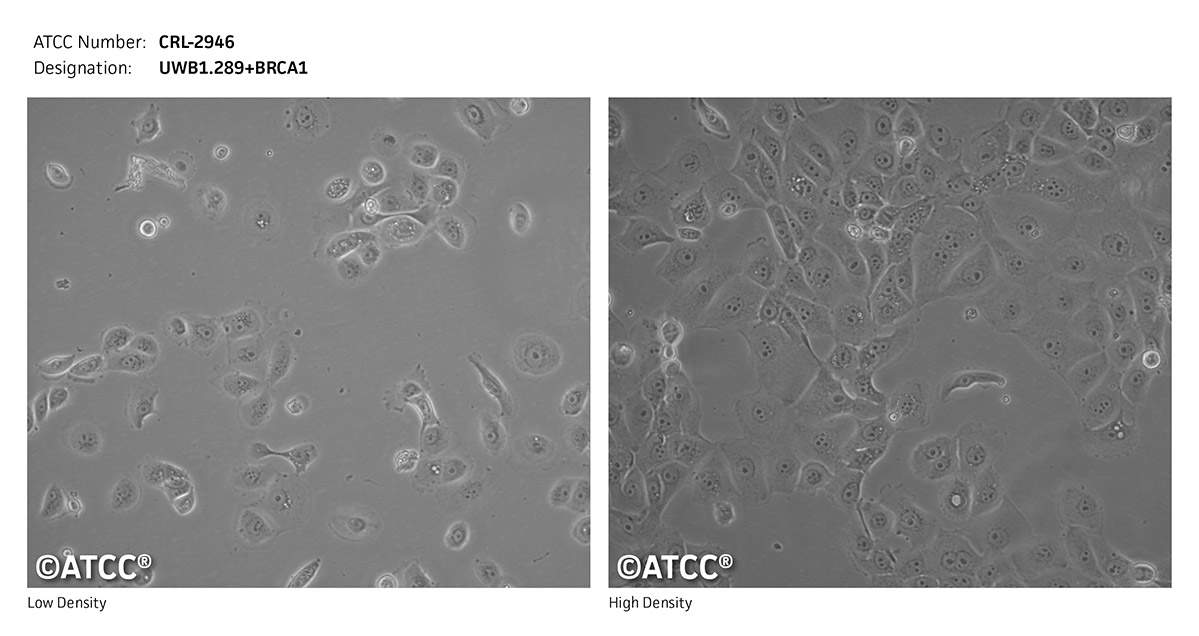 ATCC CRL-2946 micrograph