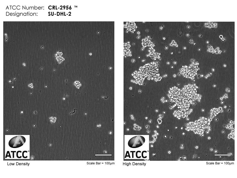 CRL-2956 Cell Micrograph