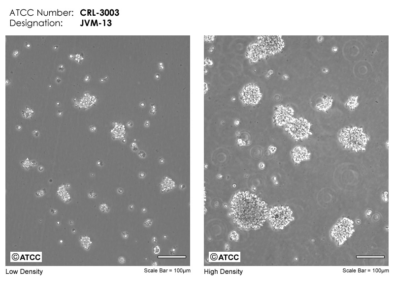 JVM-13 - CRL-3003 | ATCC