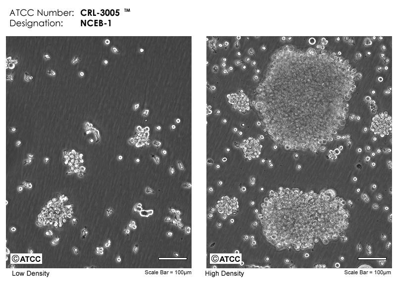 NCEB1 CRL3005 ATCC