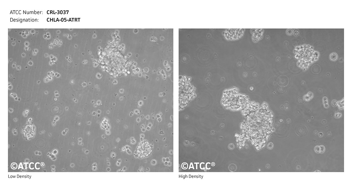Cell Micrograph of ATCC CRL-3037