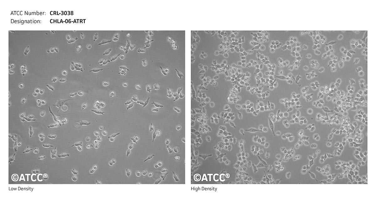 Cell Micrograph of ATCC CRL-3038