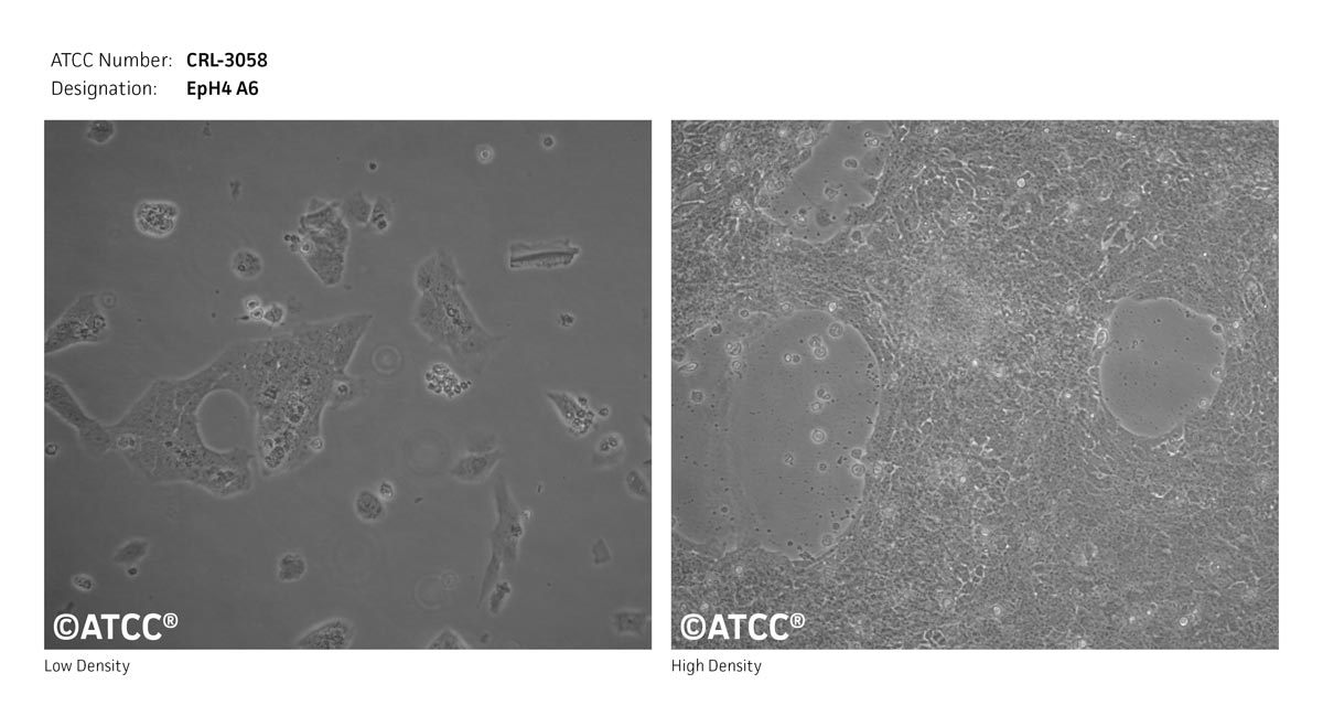 Cell Micrograph of Eph4 A6 Mammary Tumor Cells