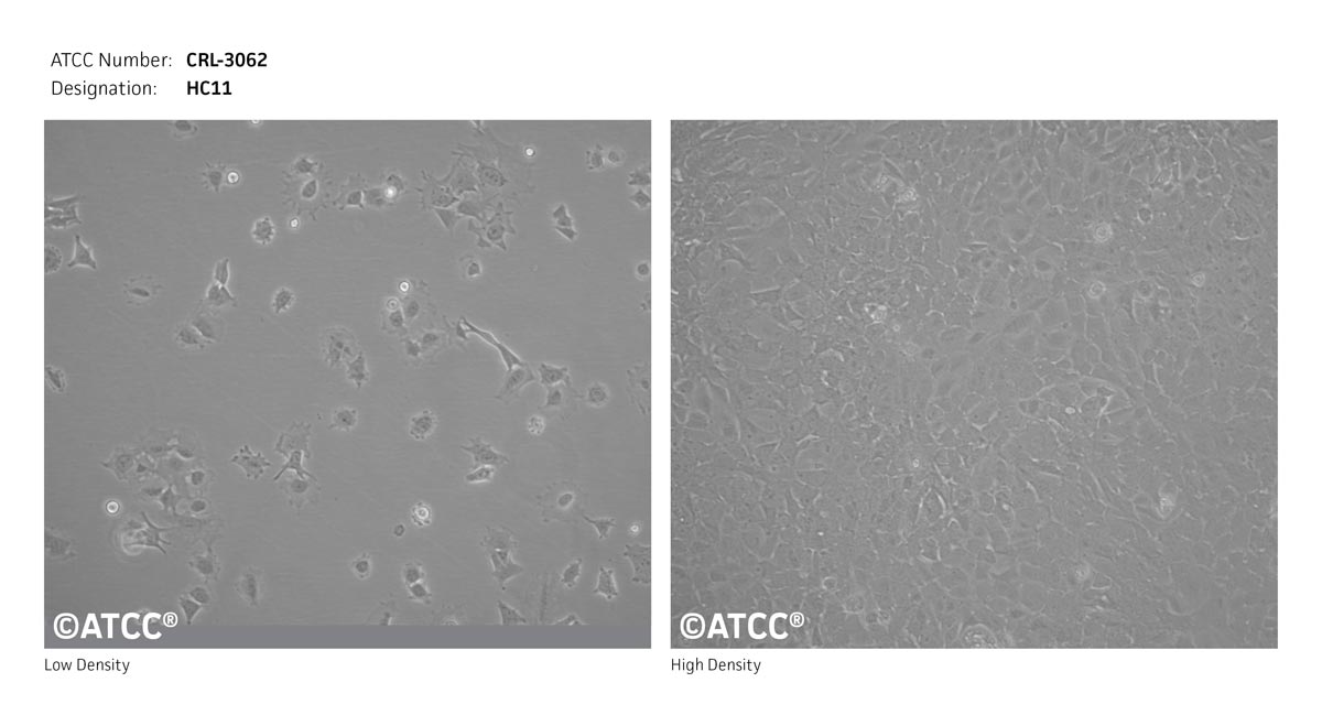 Cell Micrograph of HC11 Mammary Epithelium Cells