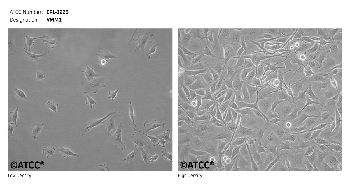ATCC CRL-3225 Cell Micrograph