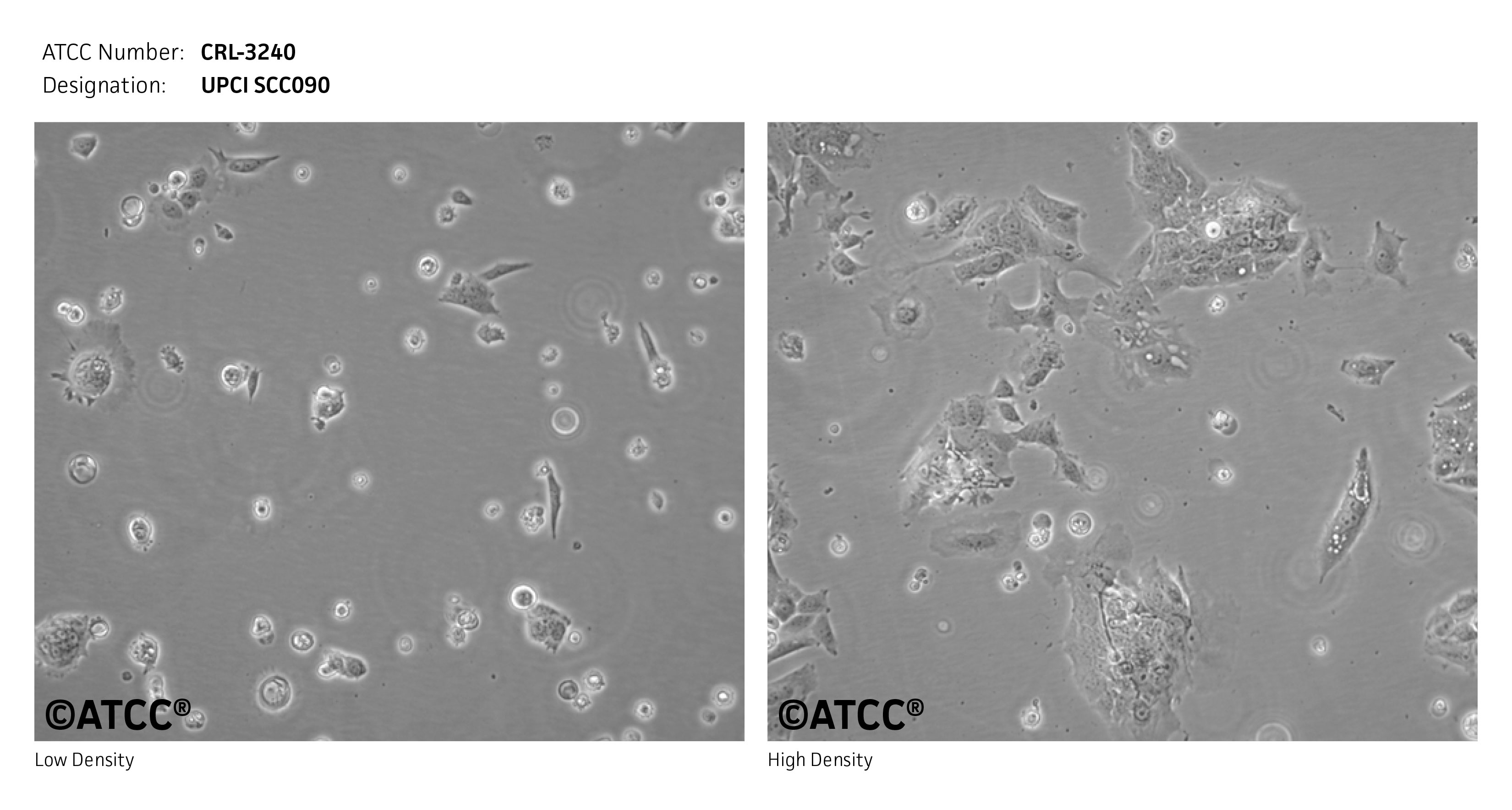 Cell Micrograph of ATCC CRL-3240