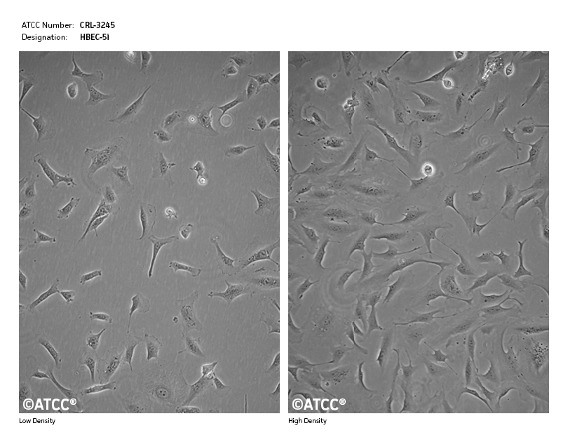 Cell Micrograph for ATCC CRL-3245