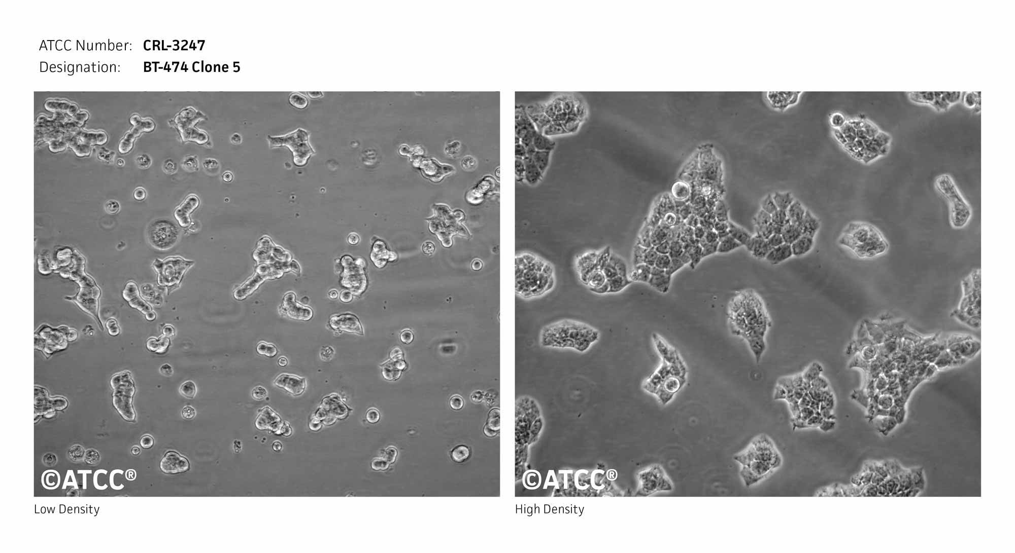 Cell Micrograph of BT-474 Clone 5 Cells