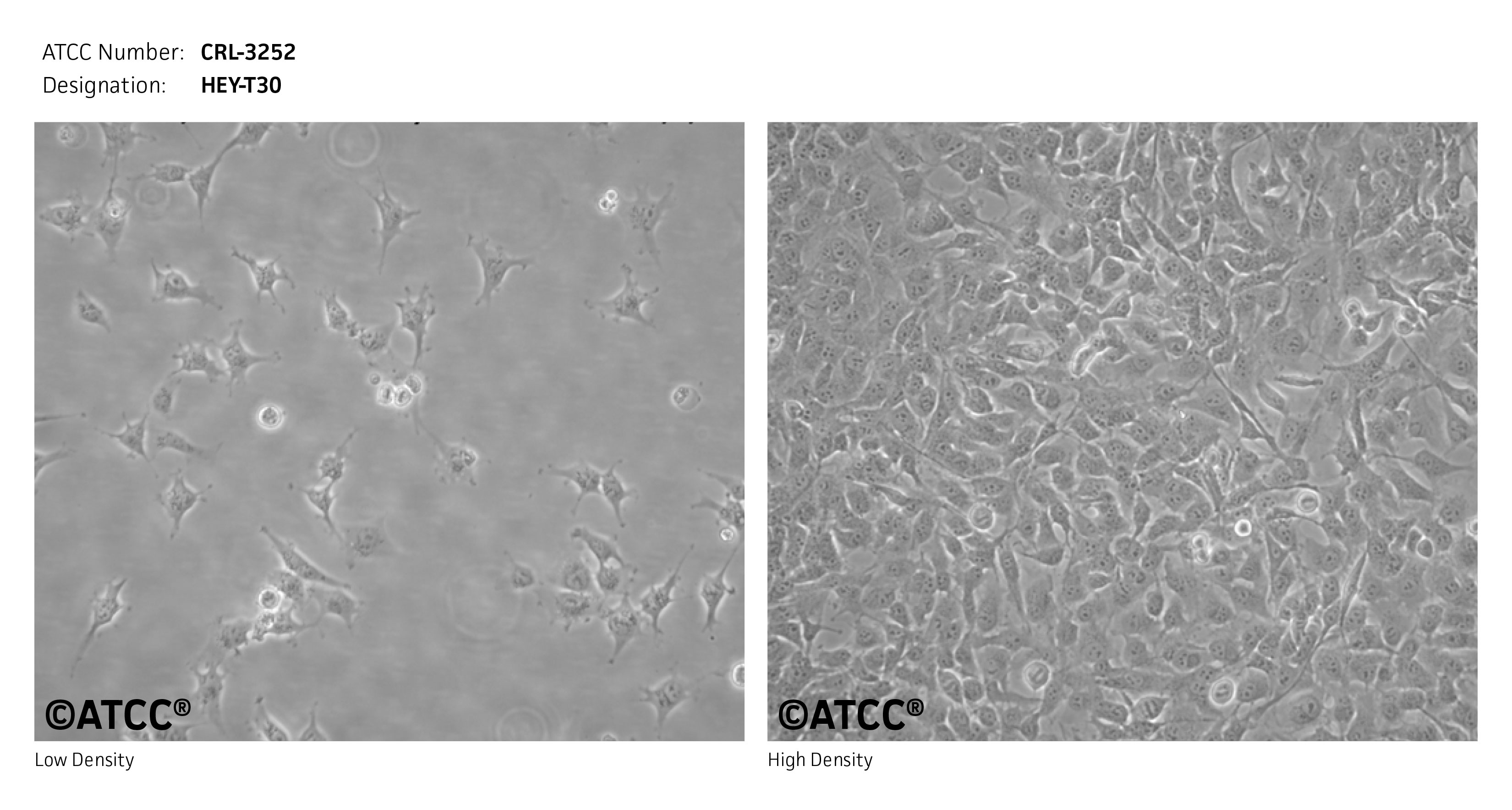 Cell Micrograph of ATCC CRL-3252