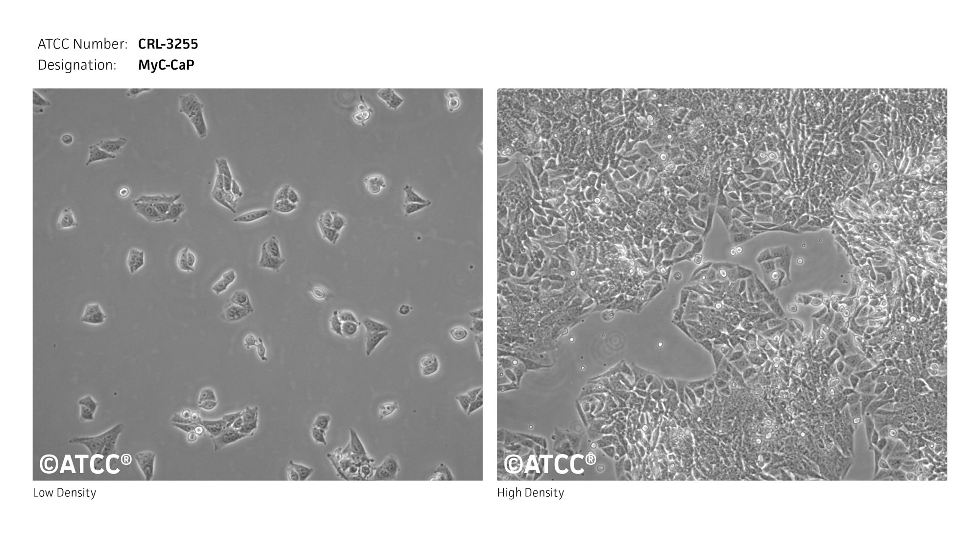 Cell Micrograph of MyC-CaP Mouse Prostate Cells