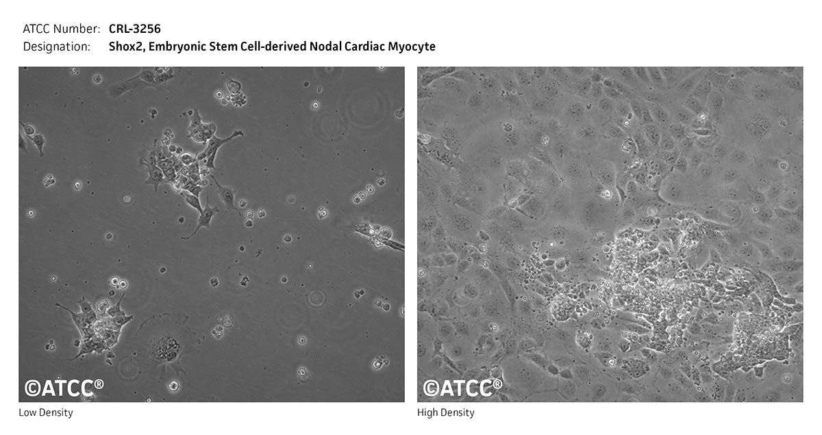 Cell Micrograph of Shox2, Embryonic Stem Cell-derived Nodal Cardiac Myocyte, ATCC CRL-3256