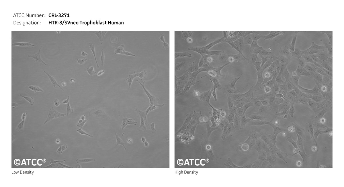 Cell Micrograph of ATCC CRL-3271 HTR-8/SVneo Human Trophoblast