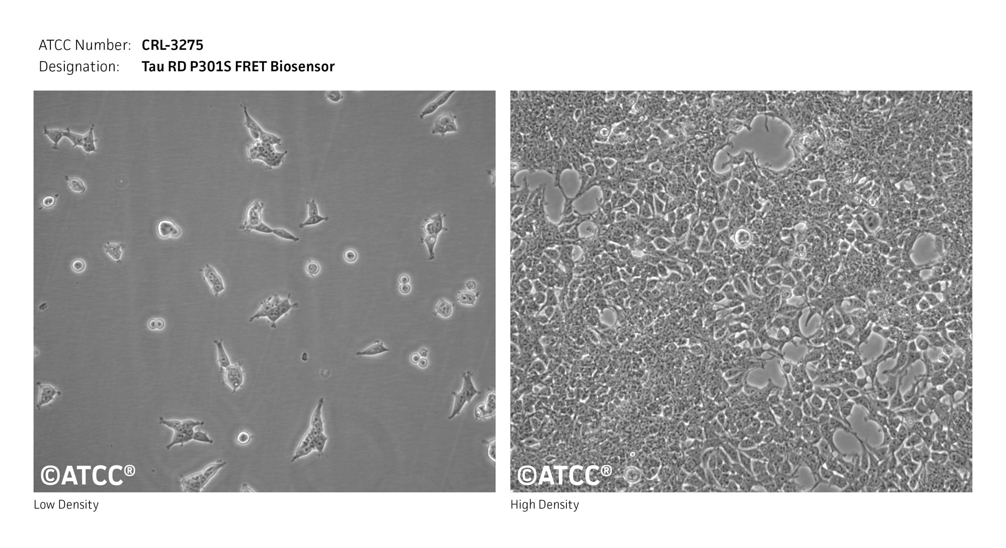 Cell Micrograph of Tau RD P301S FRET Biosensor ATCC CRL-3275