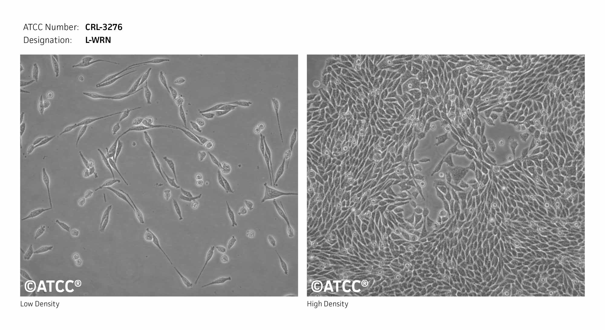 Cell Micrograph of L-WRN Mouse Transfected Fibroblast Cells