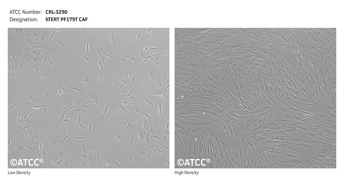Cell Micrograph of hTERT PF179T CAF, ATCC CRL-3290