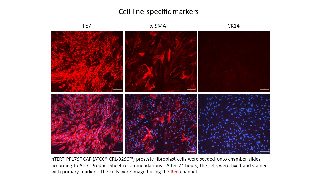 ATCC CRL-3290 Markers Data Image