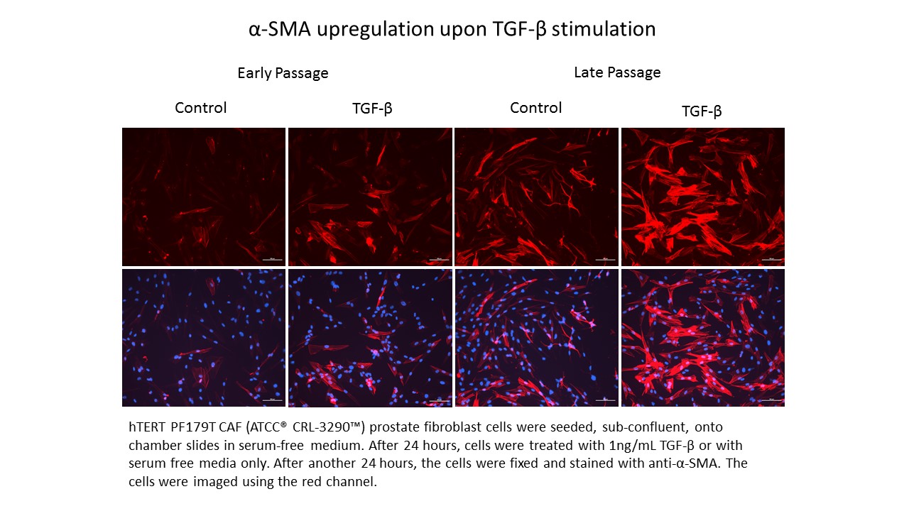 ATCC CRL-3290 SMA Expression Data