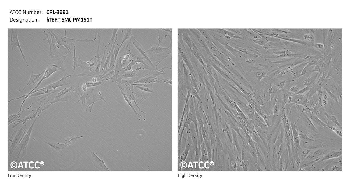 Cell Micrograph of hTERT SMC PM151T, ATCC CRL-3291