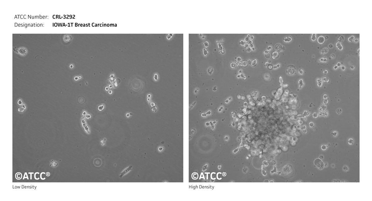 Cell Micrograph of ATCC CRL-3292, IOWA-1T cells