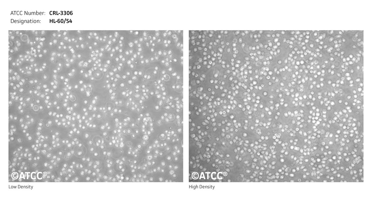 Cell Micrograph of HL-60/S4 (ATCC CRL-3306)