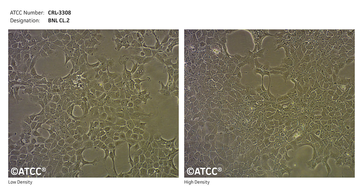 Cell Micrograph of ATCC CRL-3308