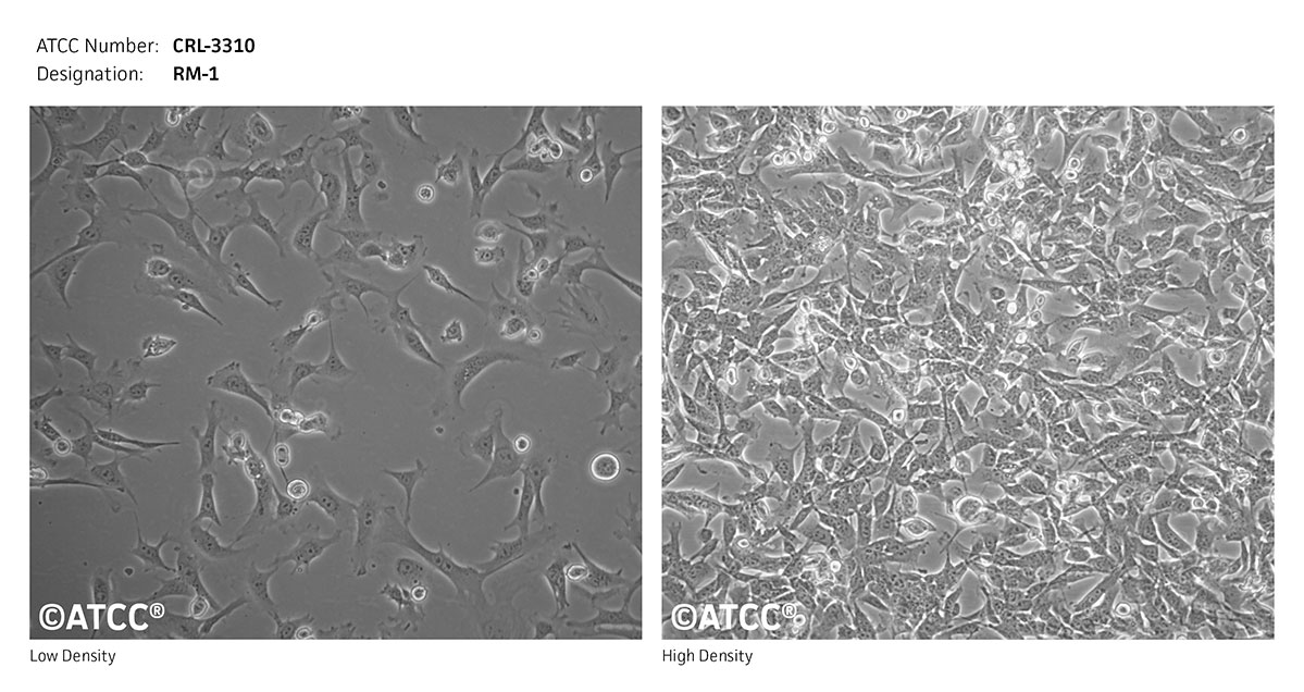 Cell Micrograph of RM-1  ATCC CRL-3310 cells