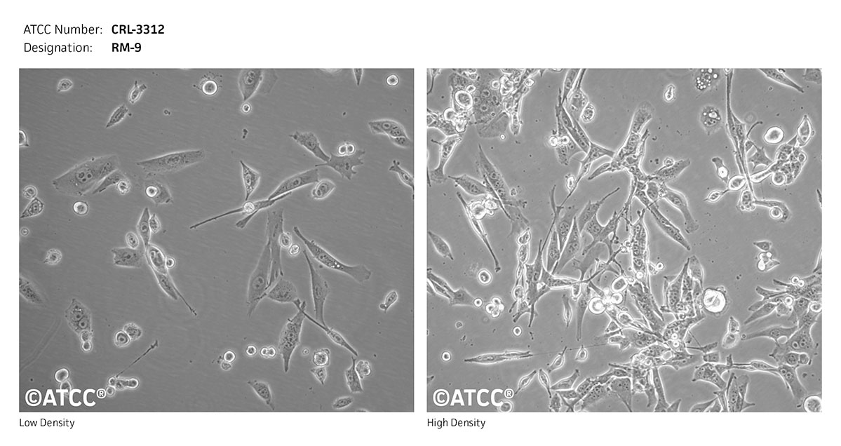 Cell Micrograph of RM-9  ATCC CRL-3312 cells
